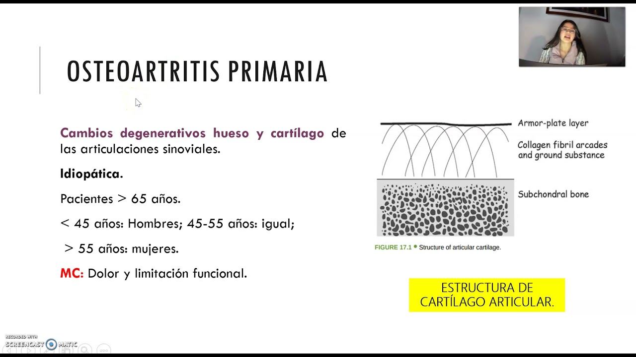 Osteoartritis