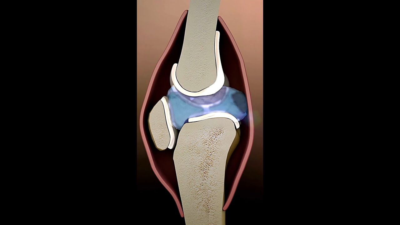 Why Do Our Joints Snap, Crackle and Pop?