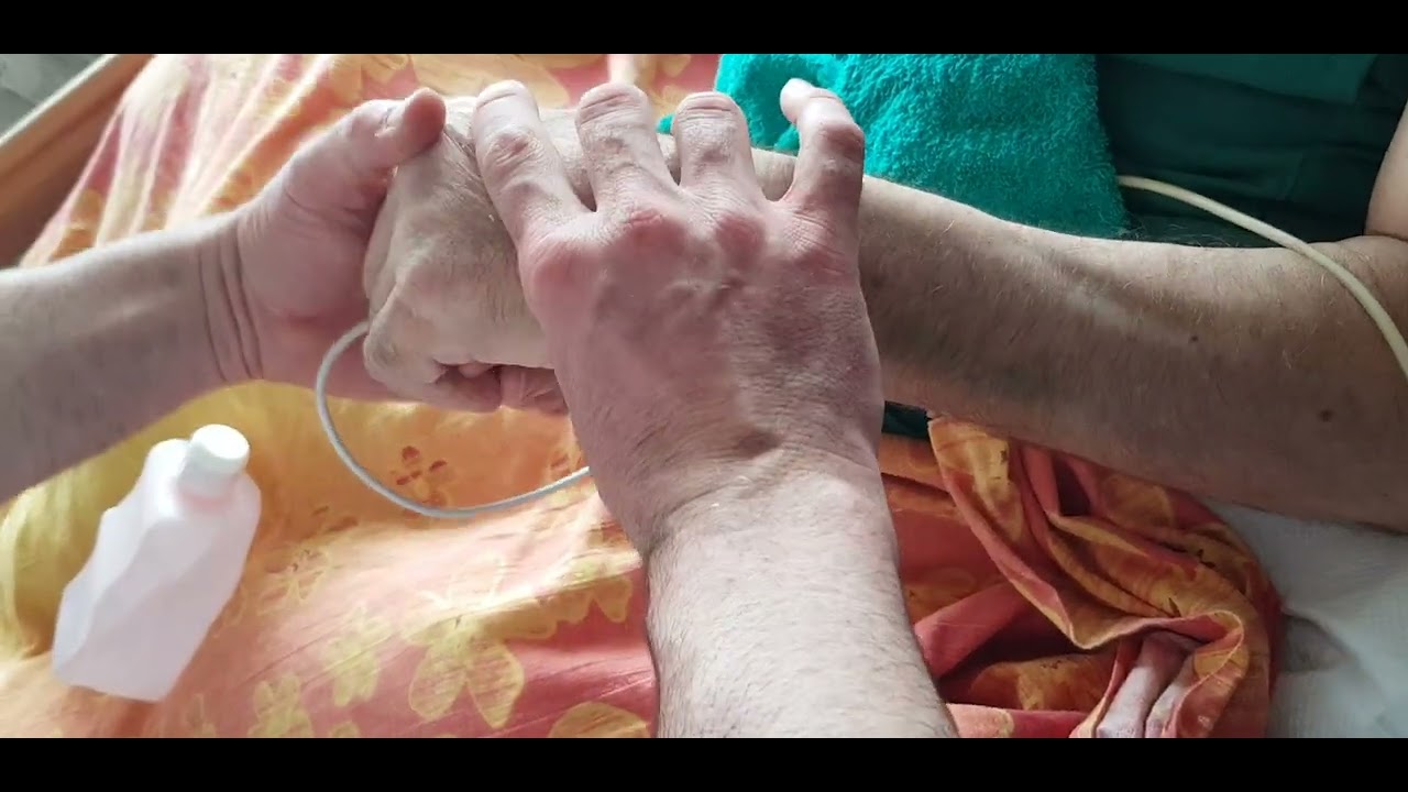 Hand mobilisieren schlaganfall ergotherapie