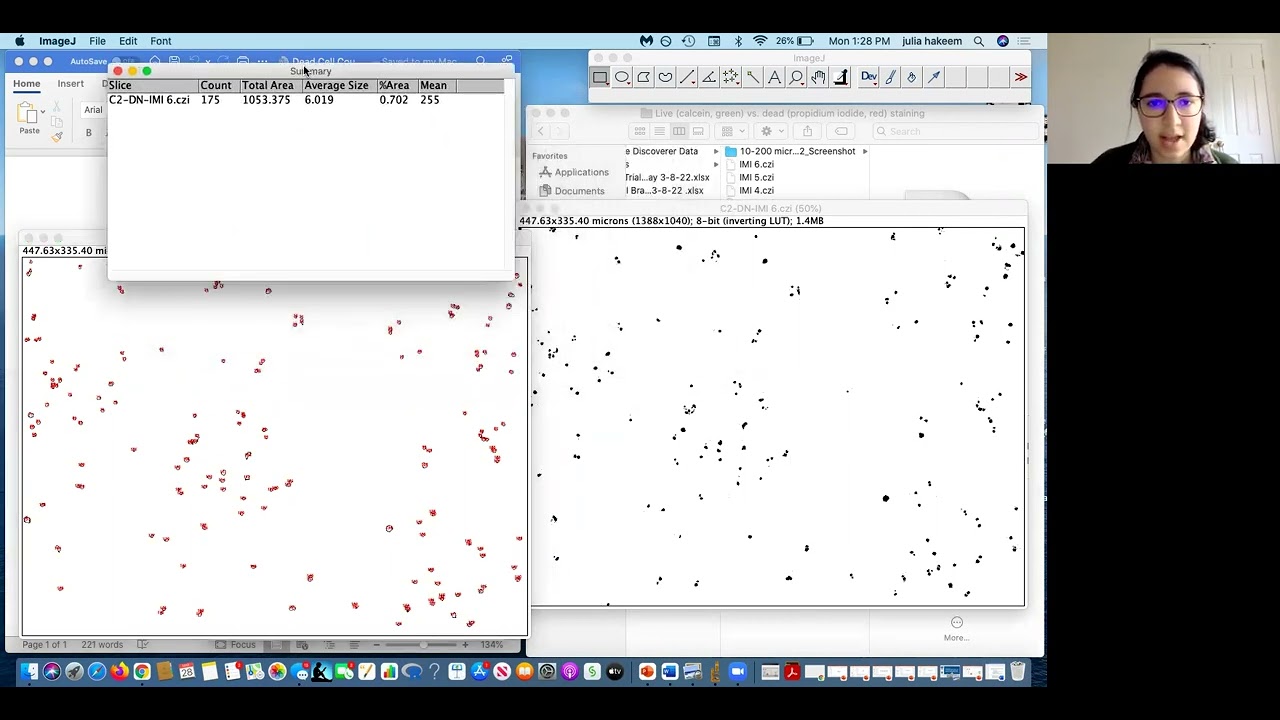 Cell Count Using ImageJ