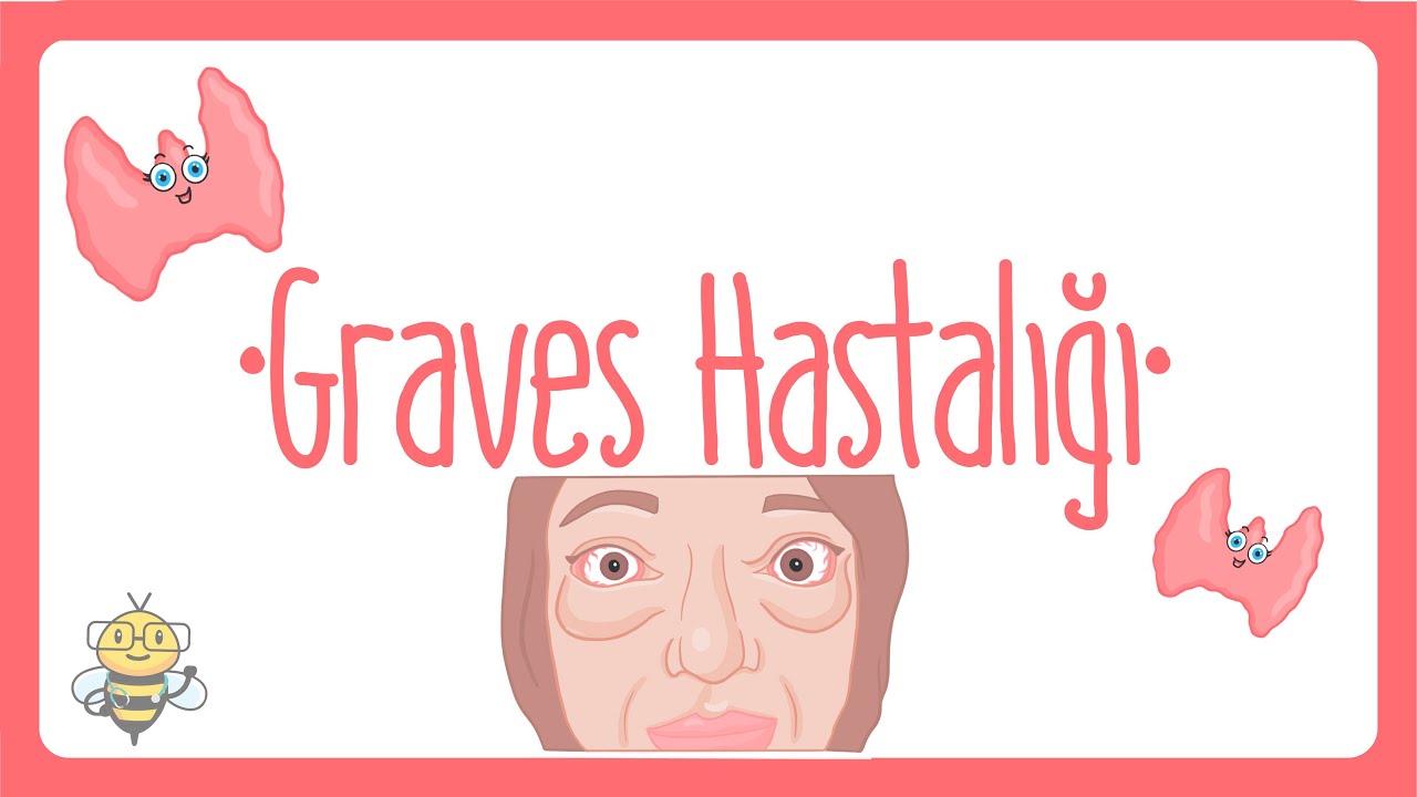 Graves Hastalığı Nedir? | Graves ve Tiroid Hakkında Bilmeniz Gerekenler