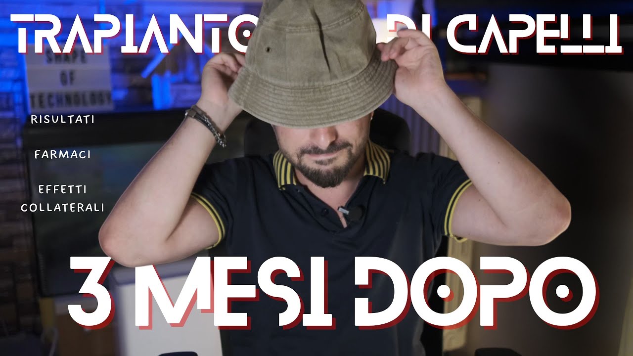 TRAPIANTO di CAPELLI 3 MESI DOPO, Come  prosegue? (Dottor Serkan Aygin)