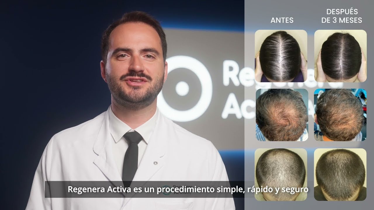 Regenera Activa | Beneficios y Características del Tratamiento para la Caída de Cabello