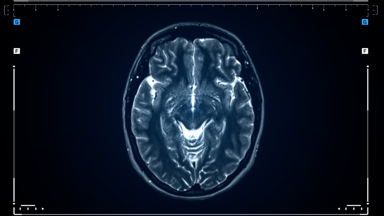 Causes Of Addiction Relapse | QED with Dr. B