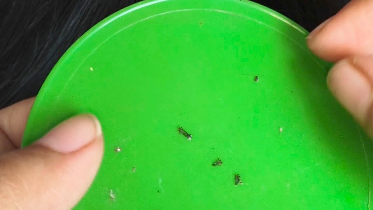 Lice picking from long Indian hair | asmr | #asmrlicepicking #asmrnitpicking #longhairasmr 