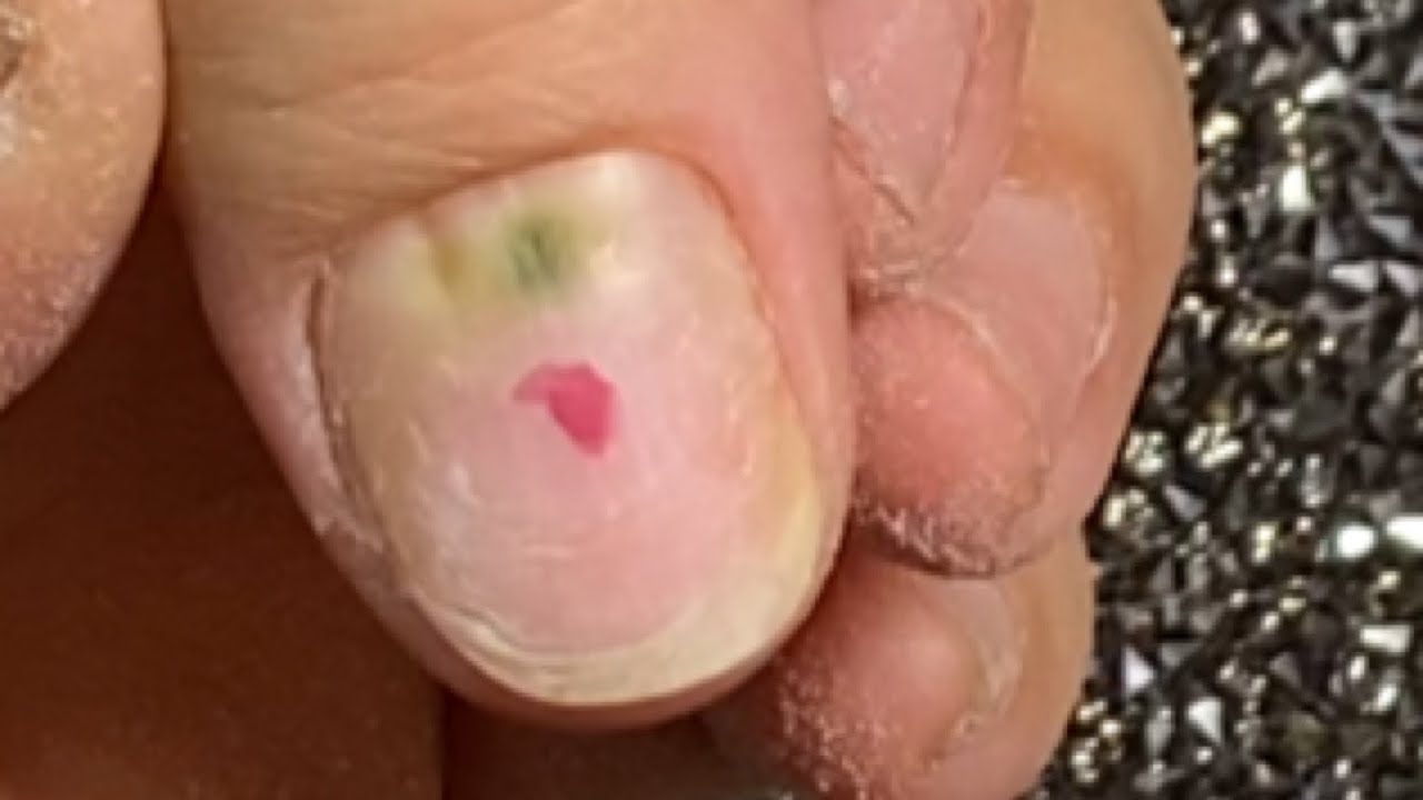 Humedad en las Uñas! Puedes Realizar un Set Así?