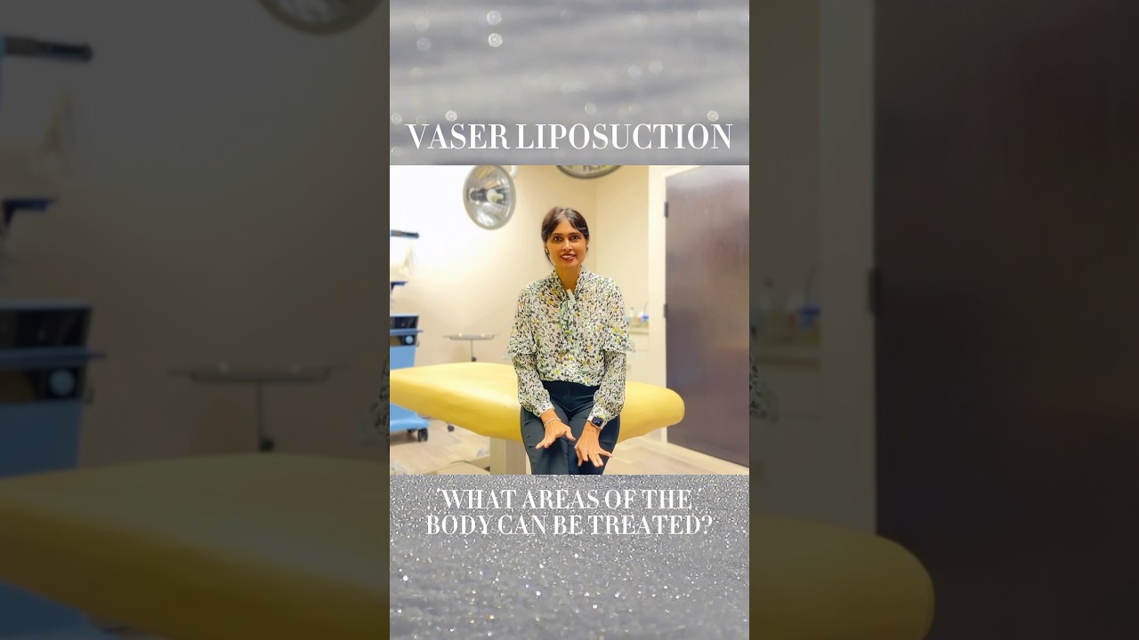 🔥СОЗДАЙТЕ ТЕЛО СВОЕЙ МЕЧТЫ с помощью липосакции Vaser! #drshalinigupta #vaserliposuction #liposuc...