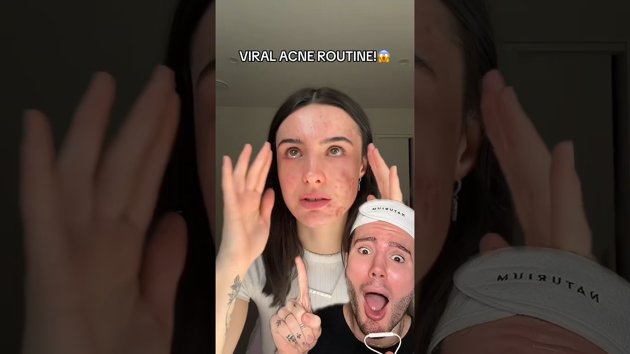 VIRAL ACNE ROUTINE!😱 (follow for more!💗) #acne #acnetreatment #beauty #skincare #skincareroutine