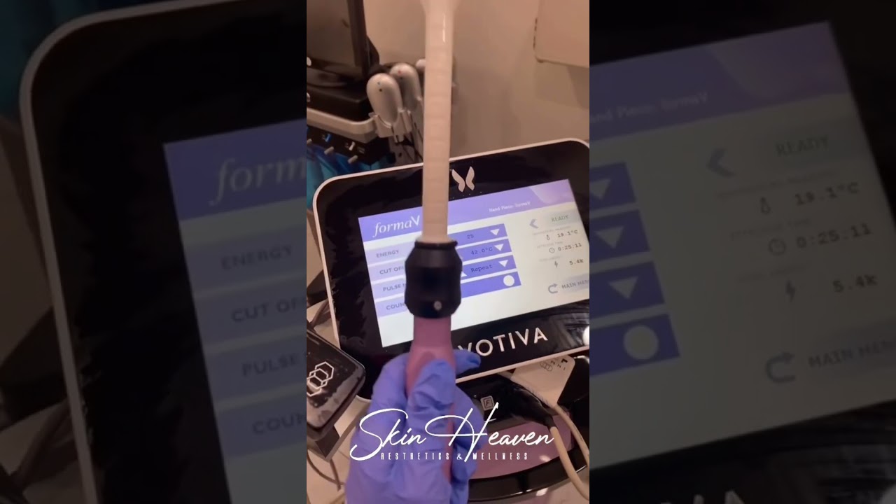 Forma V (Votiva) Vaginal Tightening | Female Rejuvenation #skinheavenmedspa #medspa #orangecounty