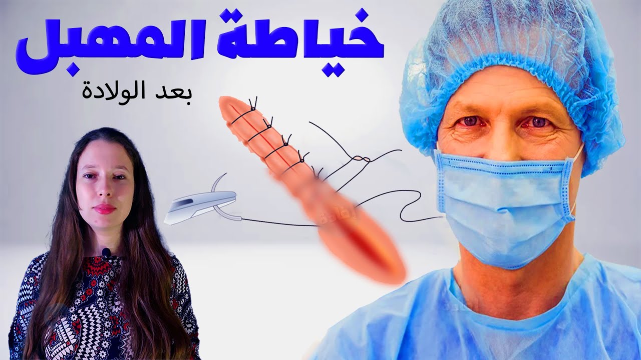 هل يمكن خياطة المهبل بعد الولادة؟
