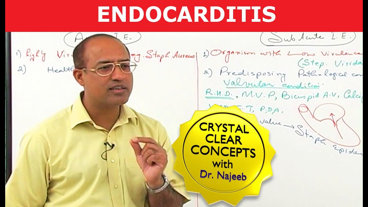 Endocarditis | Cardiac Pathology🫀