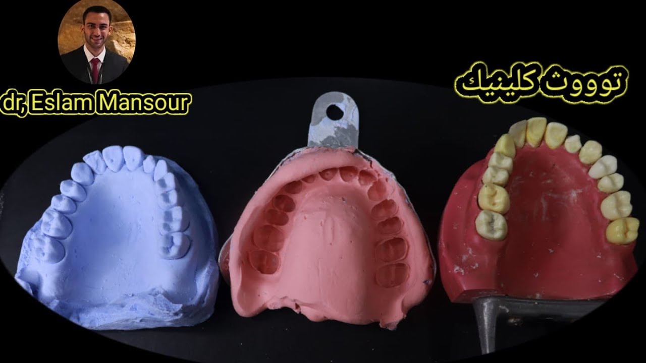 ازاي تصب الامبريشن بتاعك في العيادة بسهولة How to Pour your Impression? باقل تكلفة