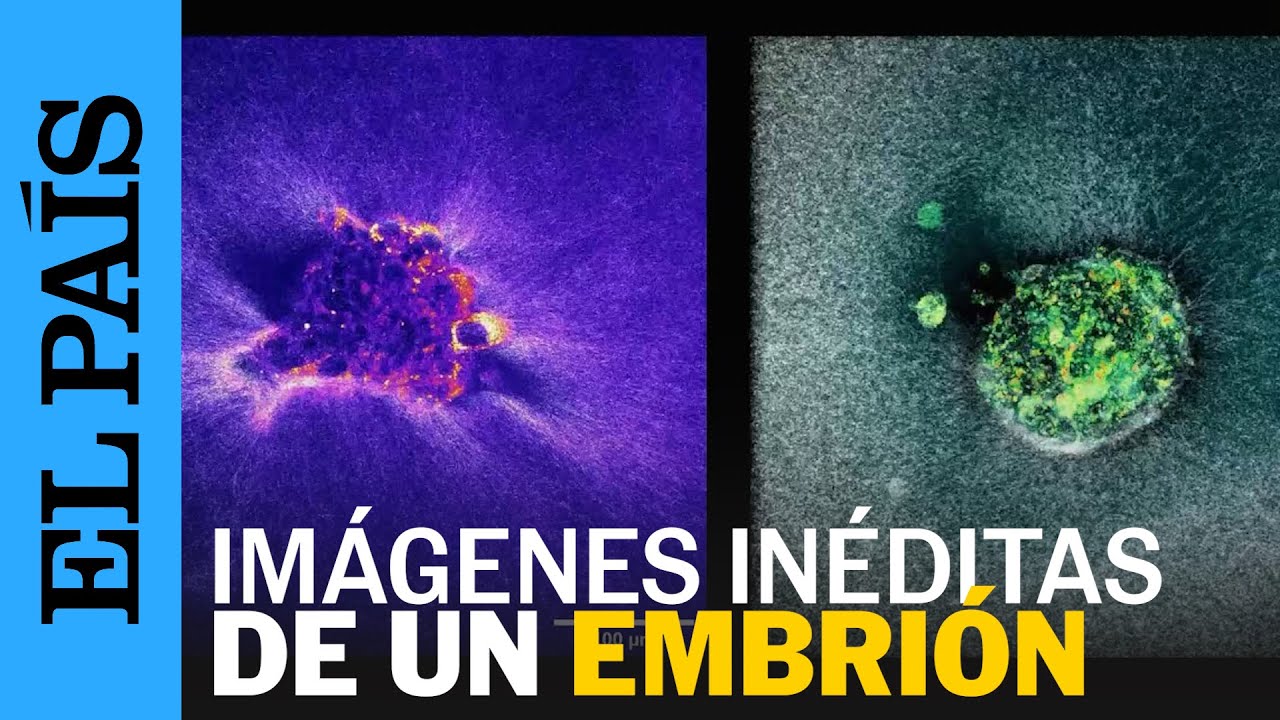 CIENCIA | Grabada por primera vez la implantaci&oacute;n de un embri&oacute;n humano | EL PA&Iacute;S