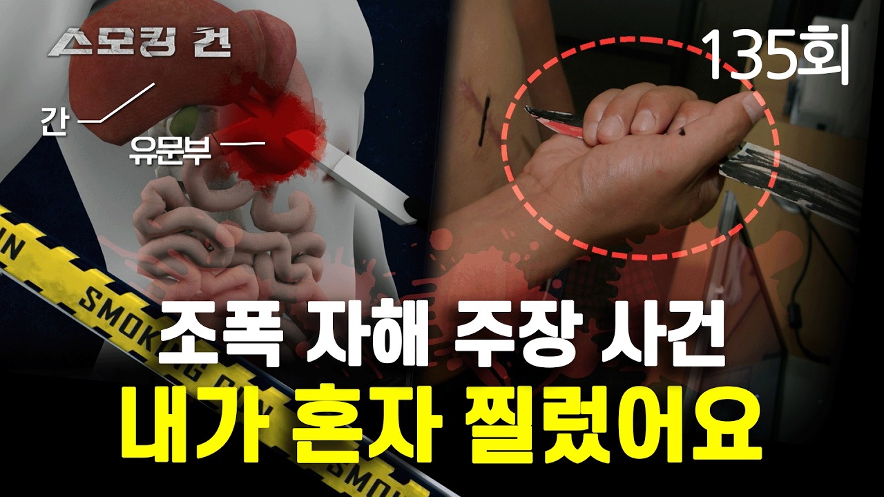 [스모킹 건] 135회 내가 혼자 찔렀어요 - 조폭 자해 주장 사건