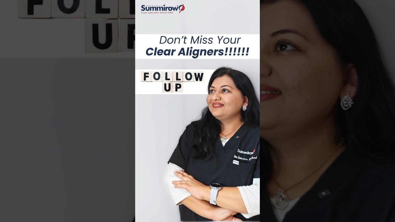 NRI Aligner Follow-Up