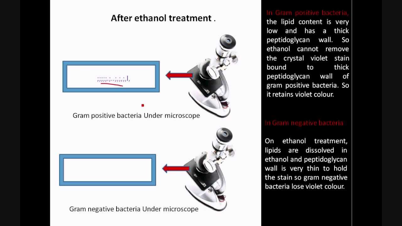 Gram staining  Principle and Procedure | Microbiology @biologyexams4u