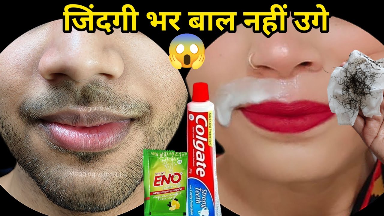 बिना Wax👉दो बूंद लगते ही 44 साल भाभी जी के चेहरे से दाढ़ी,मूछ साफ😱|| facial hair treatment in Hindi