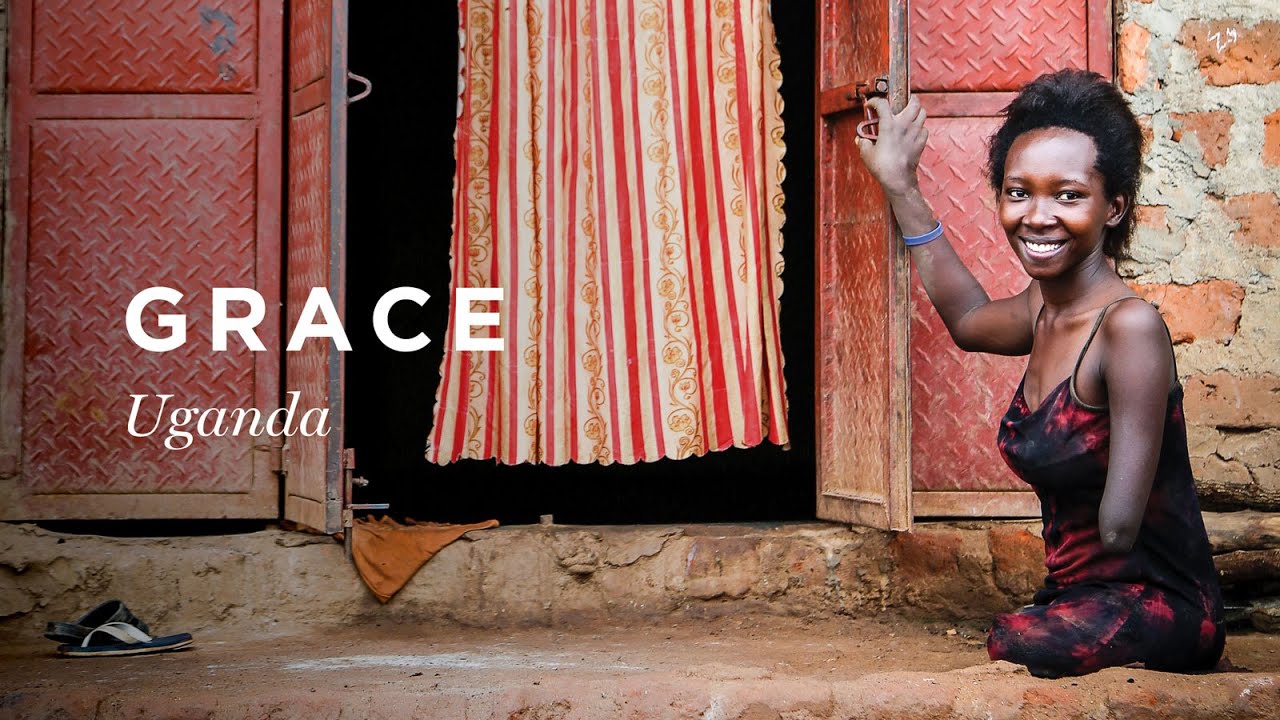 I am Grace | Born Missing Limbs | Compassion Australia