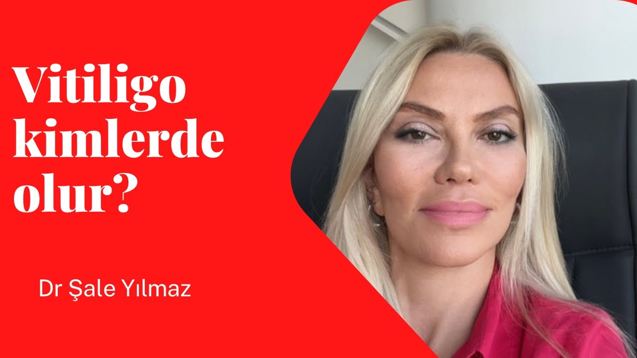 VİTİLİGO KİMLERDE GÖRÜLÜR? VİTİLİGOYU ÖNLEMEK MÜMKÜN MÜ? Dr ŞALE YILMAZ