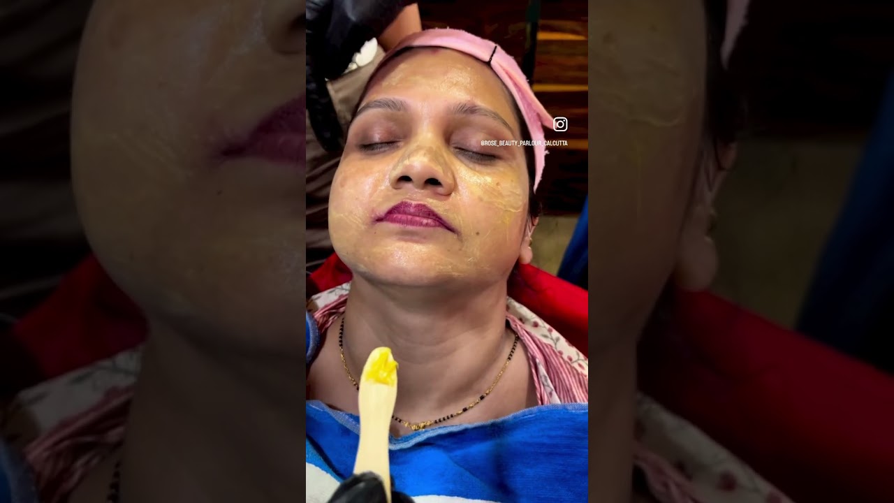 Yellow peel treatment