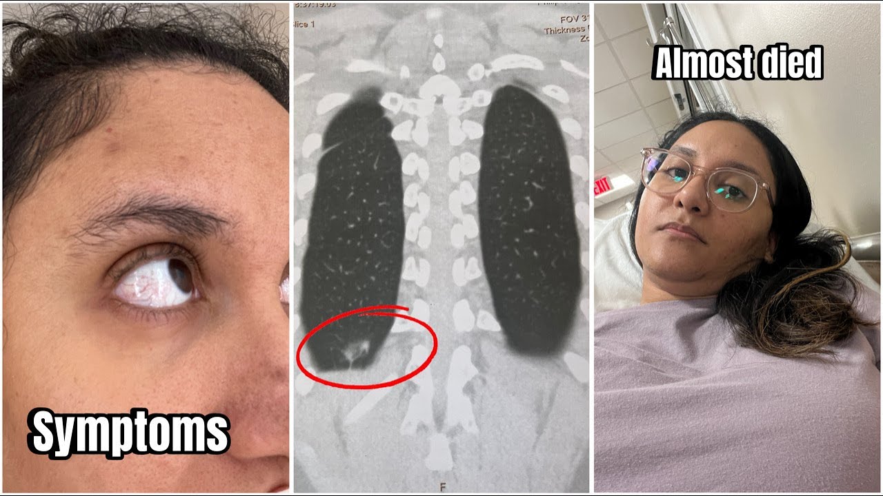 I HAD TOXIC MOLD SYNDROME / How the healthcare system failed me