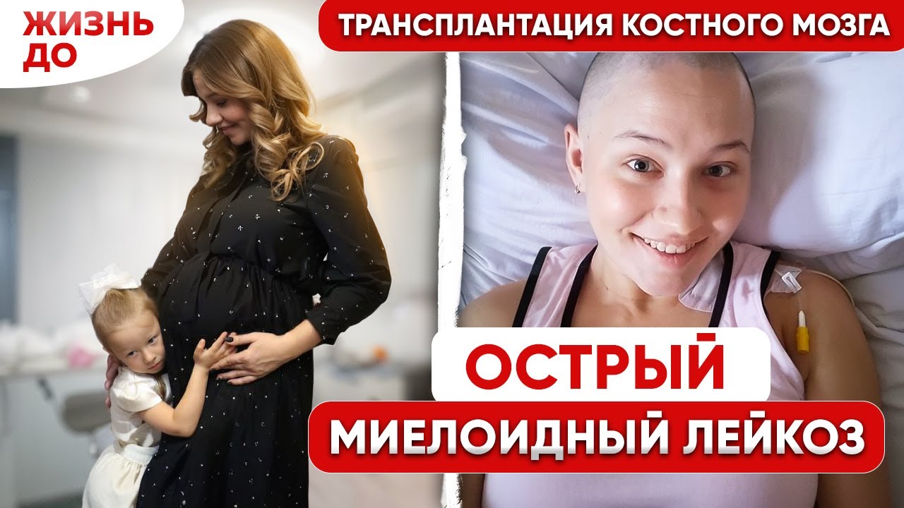Думала, что это АНЕМИЯ, а оказалась ЛЕЙКЕМИЯ во время беременности. Моя история борьбы с РАКОМ КРОВИ