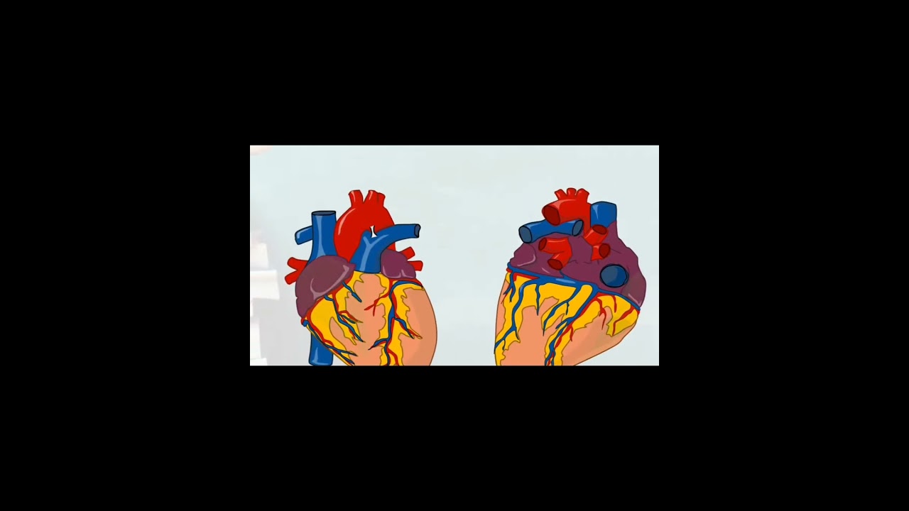 Blood supply of heart #anatomy #mbbs # USMLE