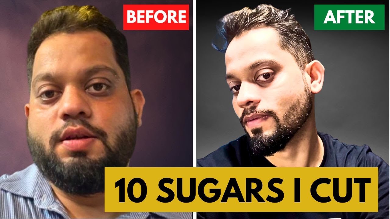 I Cut These 10 Sugar Foods | Face Fat Gone | Transformation