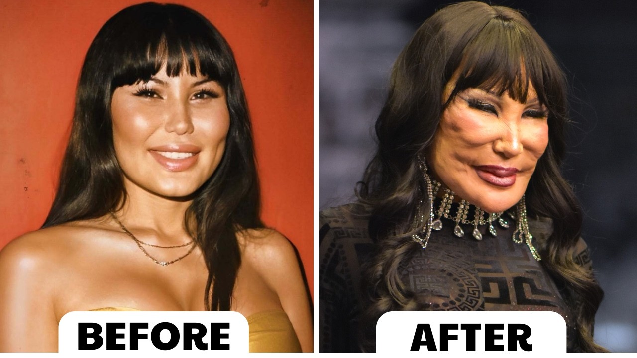 15 Celebrities Plastic Surgery Cases That Shocked Fans | Then and Now 2026