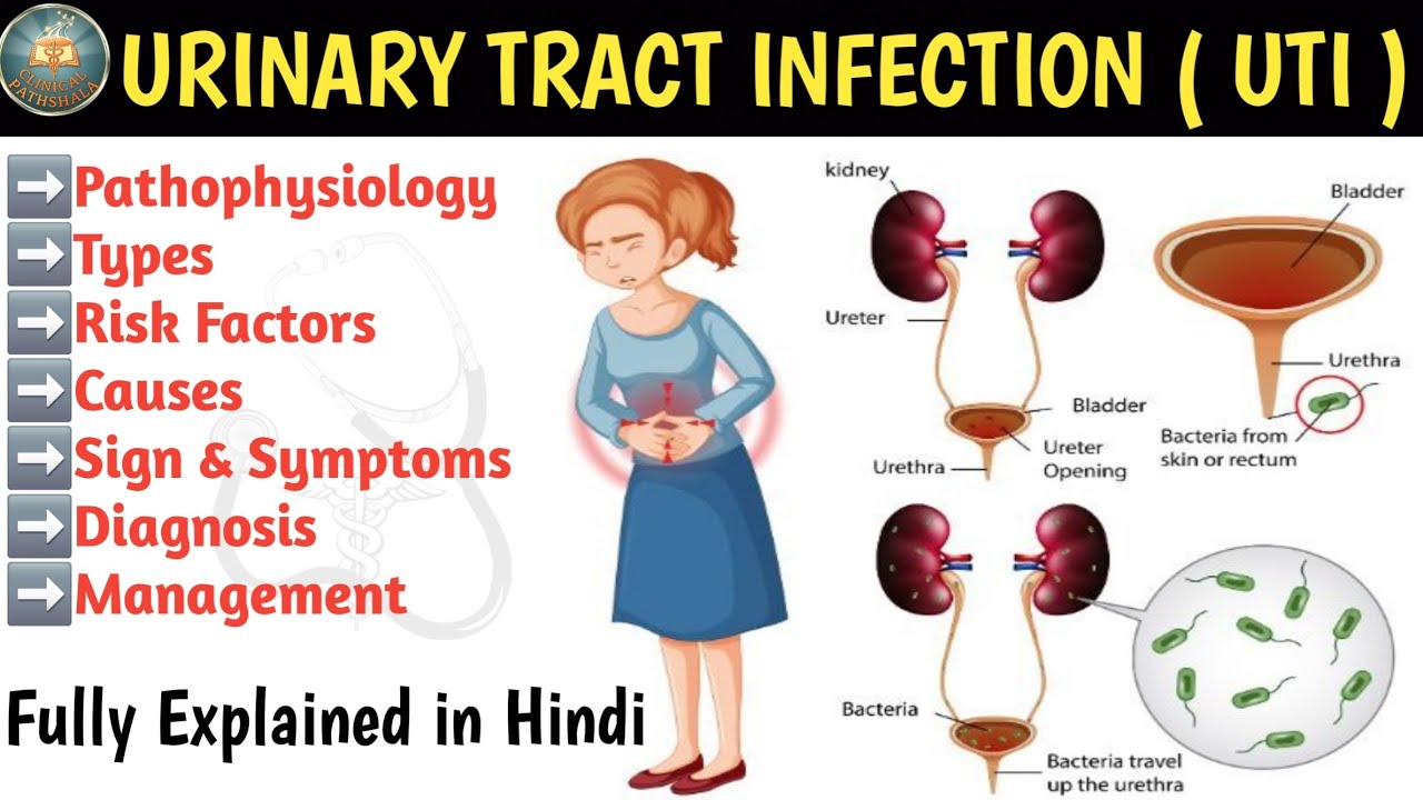 Urinary Tract Infection ( UTI ) | Pathophysiology | Types | Symptoms & Management in Hindi 