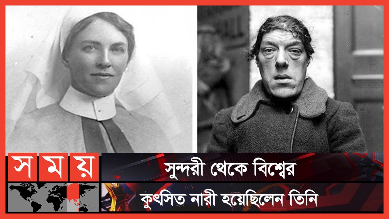 বিশ্বের কুৎসিত নারী, যে কারণে তিনি সেরা মা | Mary Ann Bevan | Somoy TV