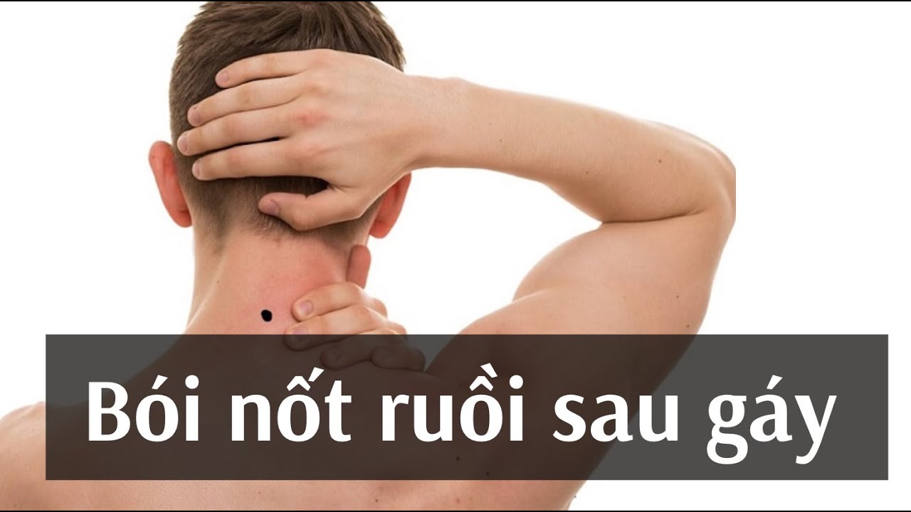 Nốt ruồi sau gáy đàn ông, phụ nữ có ý nghĩa gì? Hung hay Cát?