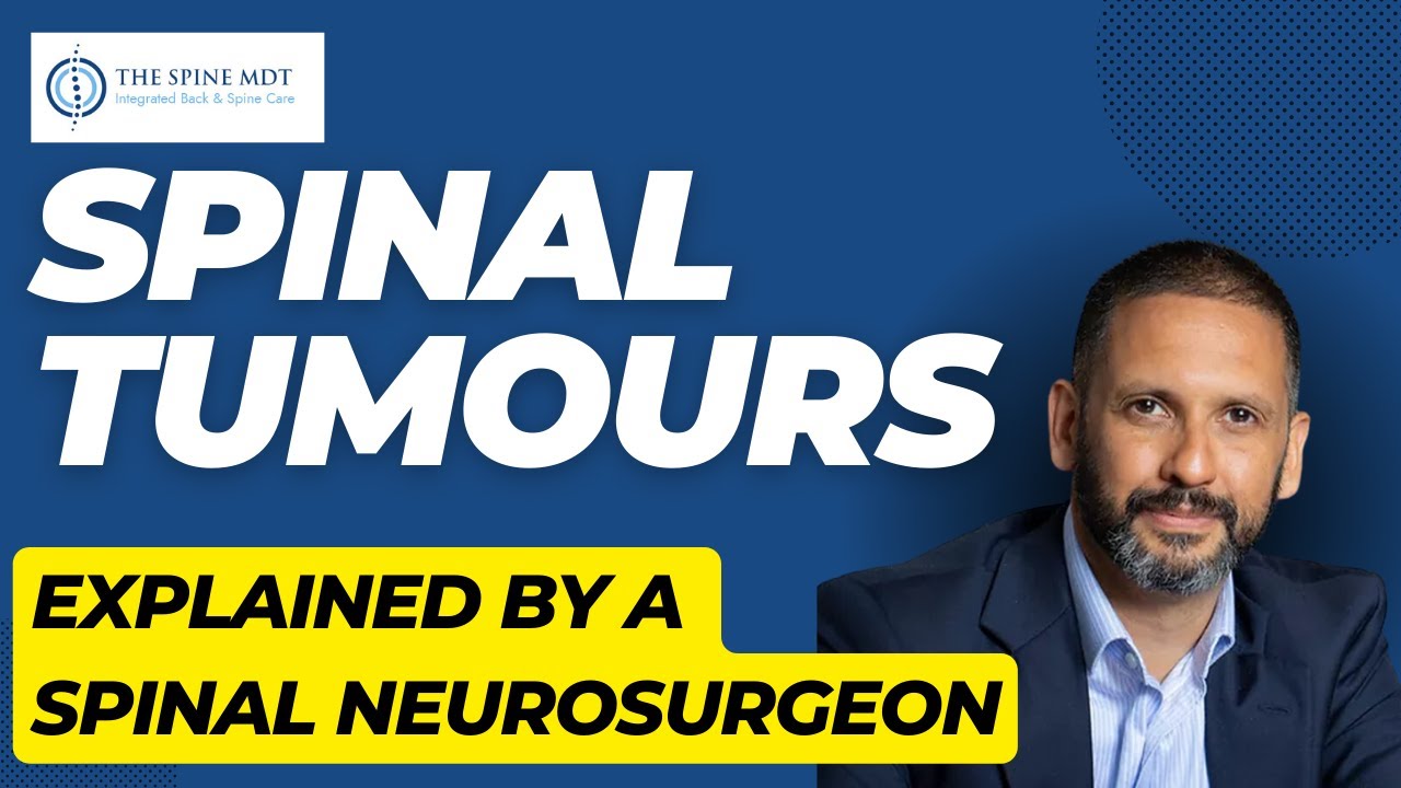 Spinal Tumours - Explained by a Spinal Neurosurgeon