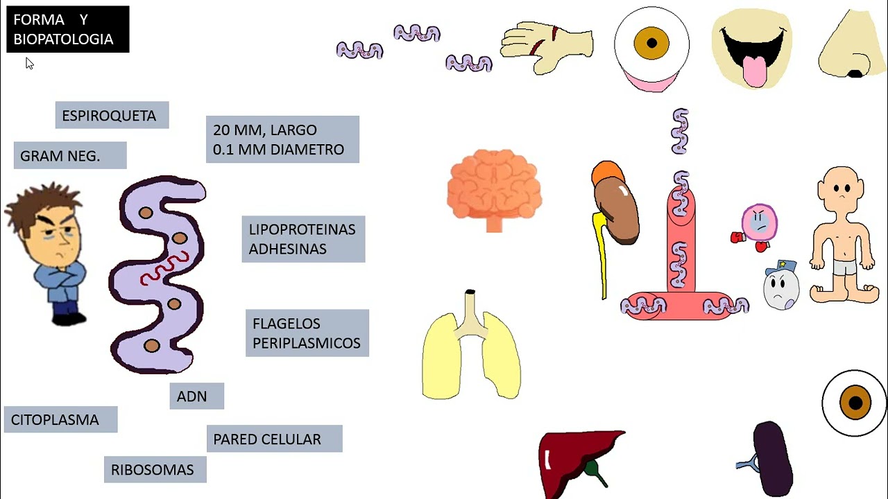 Leptospirosis, Leptospira Interrogans, Biflexa.