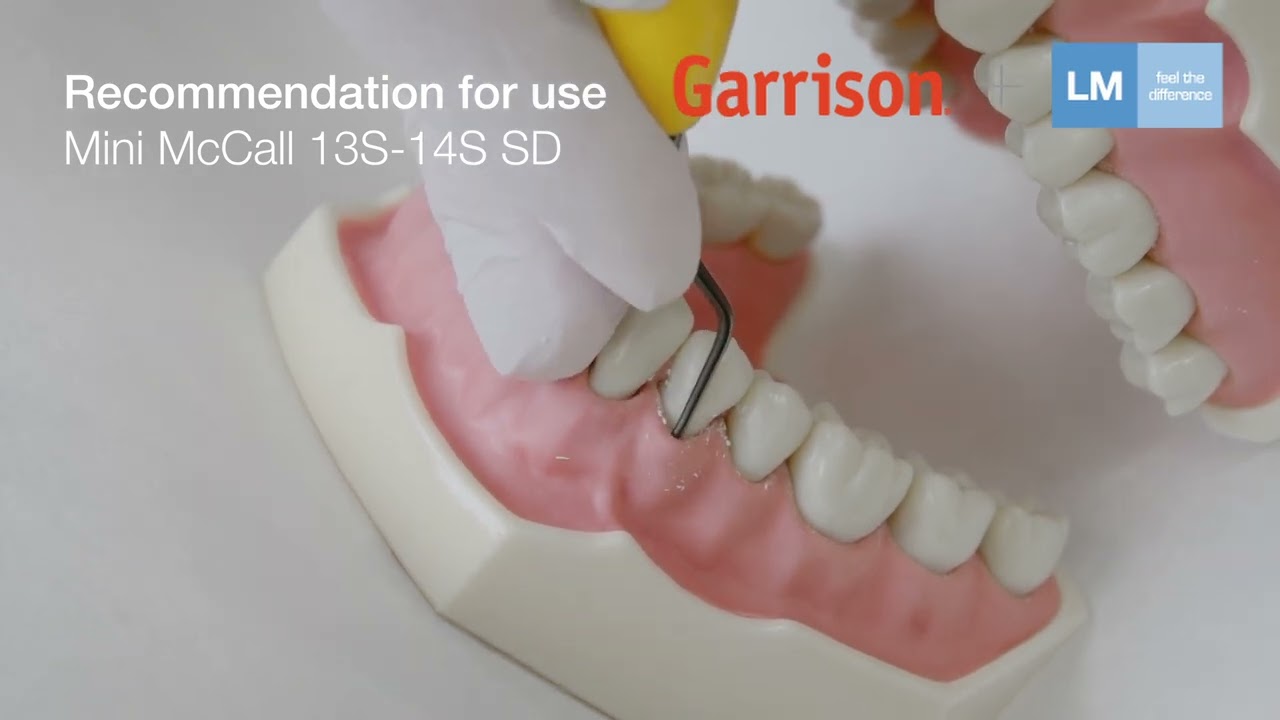 How to use Mini McCall 13S-14S LM dental hand instrument | Garrison