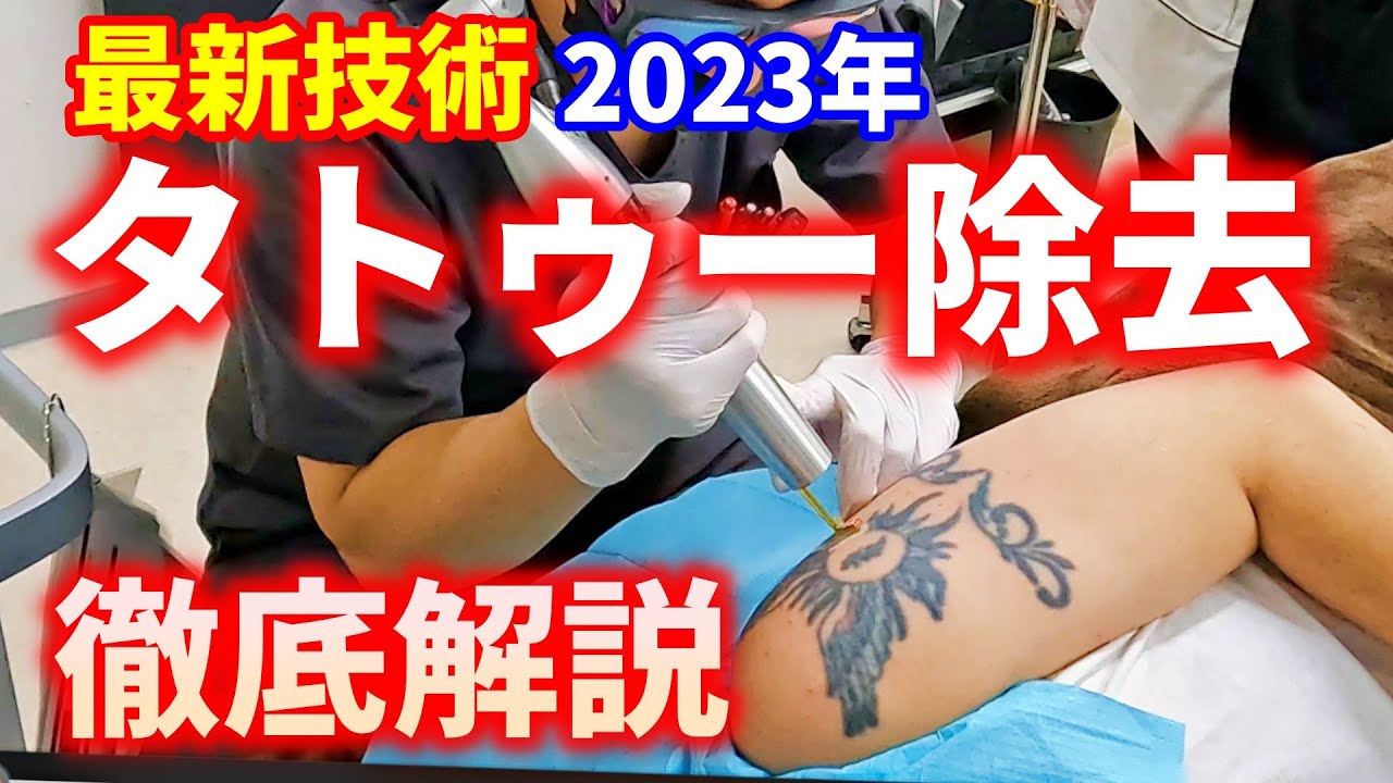 施術全公開！タトゥー除去を専門医師が徹底解説