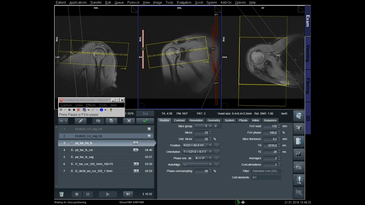 MRI Shoulder Joint Planning and Protocol Siemens 1.5 Tesla