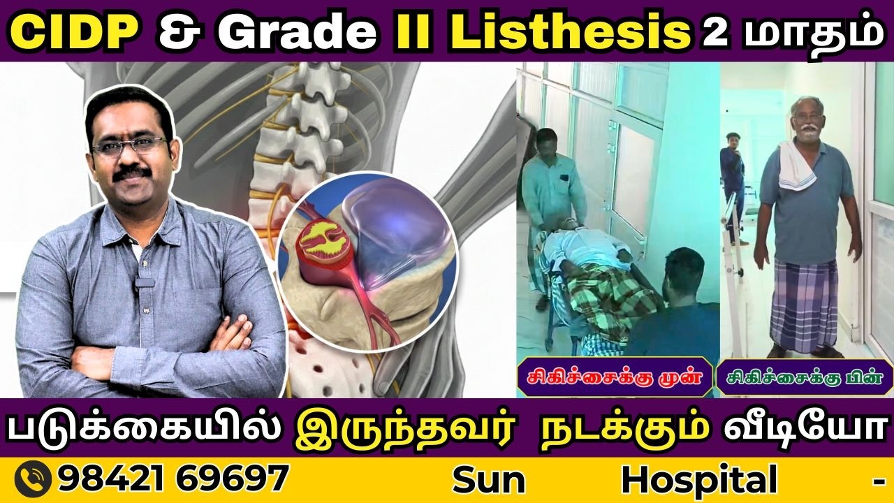 CIDP + Grade II Spondylolisthesis | 2 மாதம் படுக்கையில் இருந்தவர் நடக்கும் வீடியோ | Sun Physio