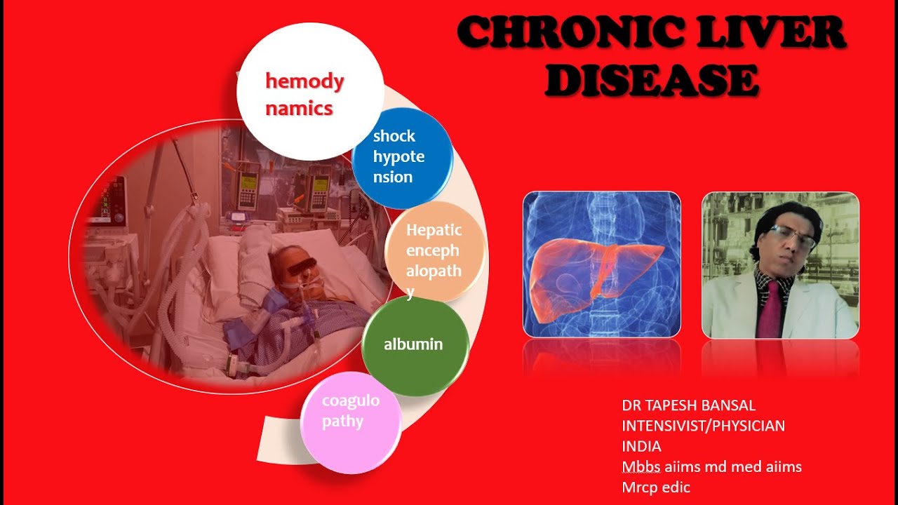 CIRRHOSIS /CLD complications part 1 -SHOCK HE COAGULOPATHY ACLF # dr tapesh bansal