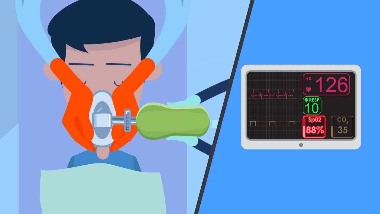 Mask Seal - Safe Manual Ventilation Educational Series