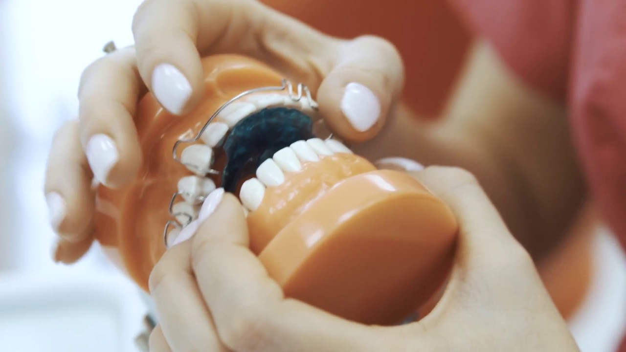 Rodzaje aparatów ortodontycznych - dr n. med. Izabela Walawender