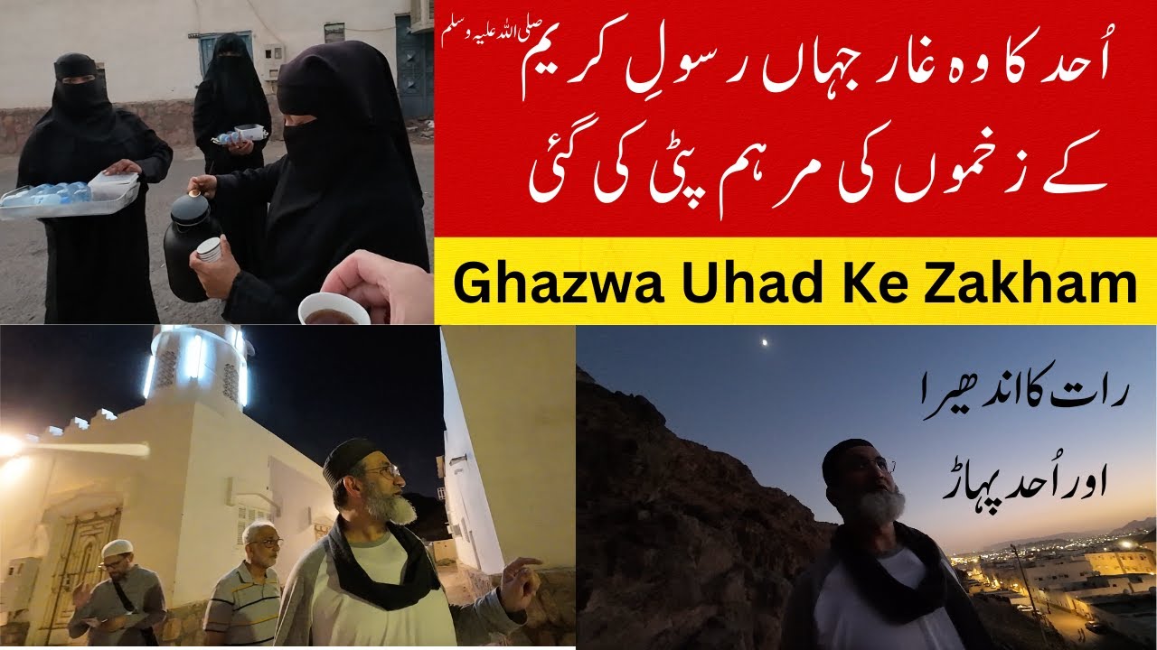 Wounds Of Uhad | Ghazwa Uhad Ke Zakham
