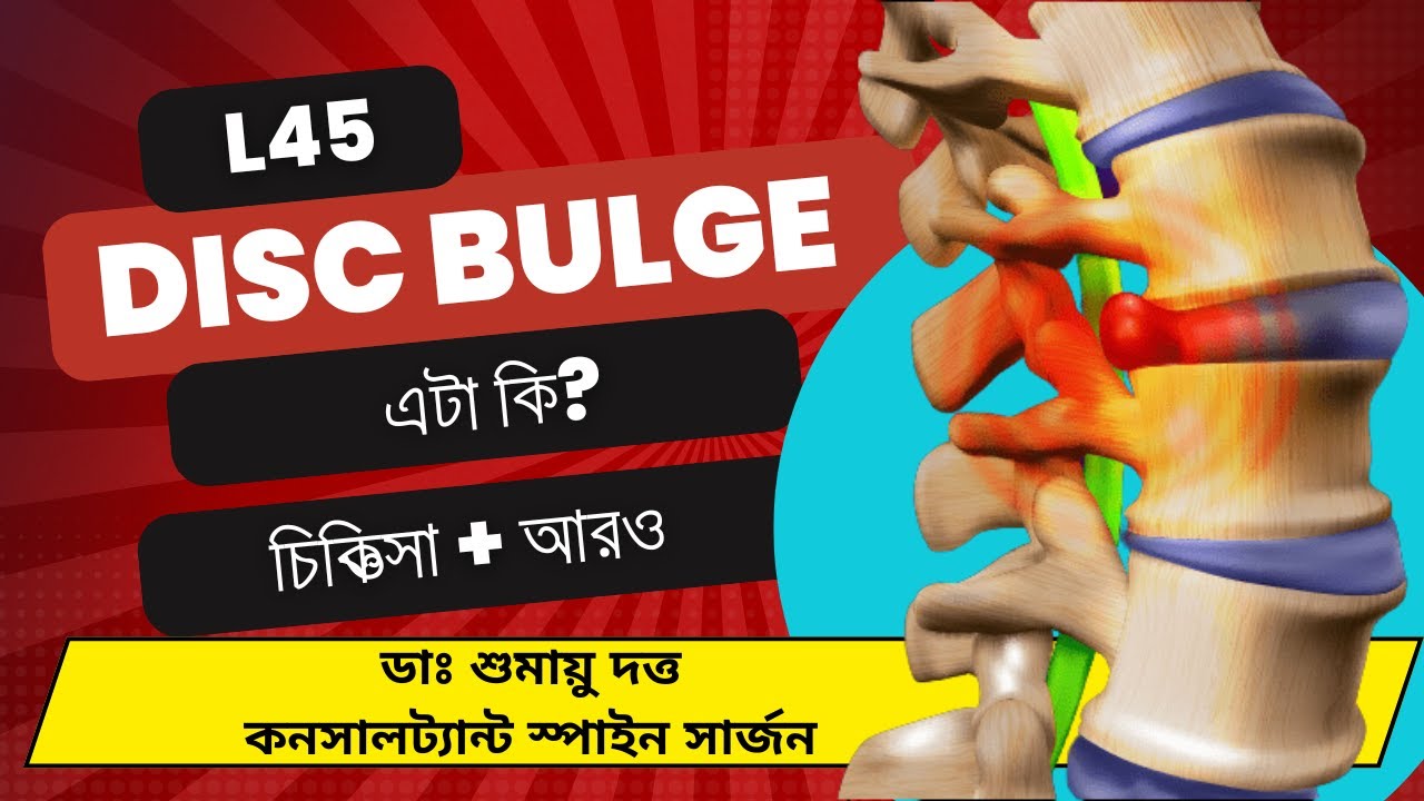 L45 Disc Bulge Treatment in Kolkata || Dr. Shumayou Dutta