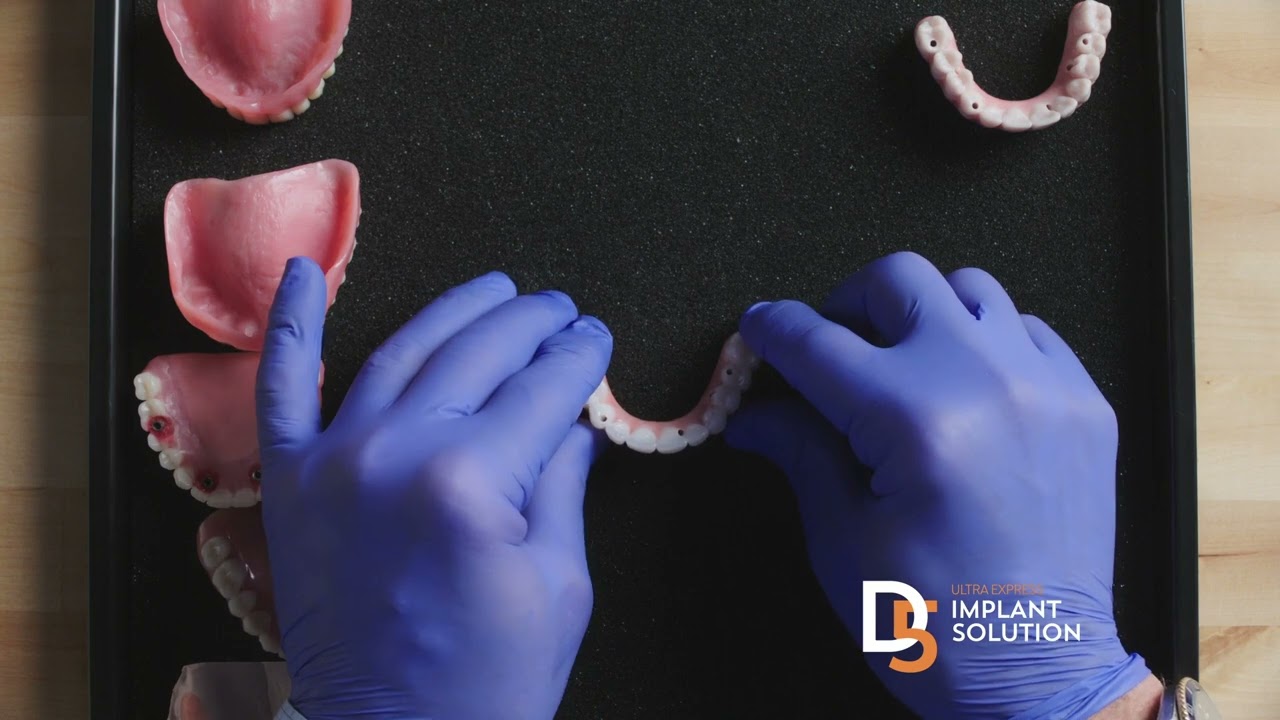 D5 Teeth - Teeth In A Day Comparison