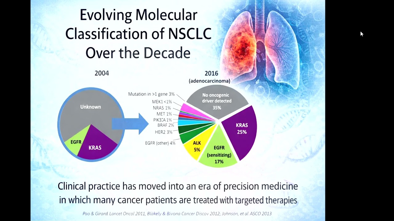 [New Of Lung Cancer]