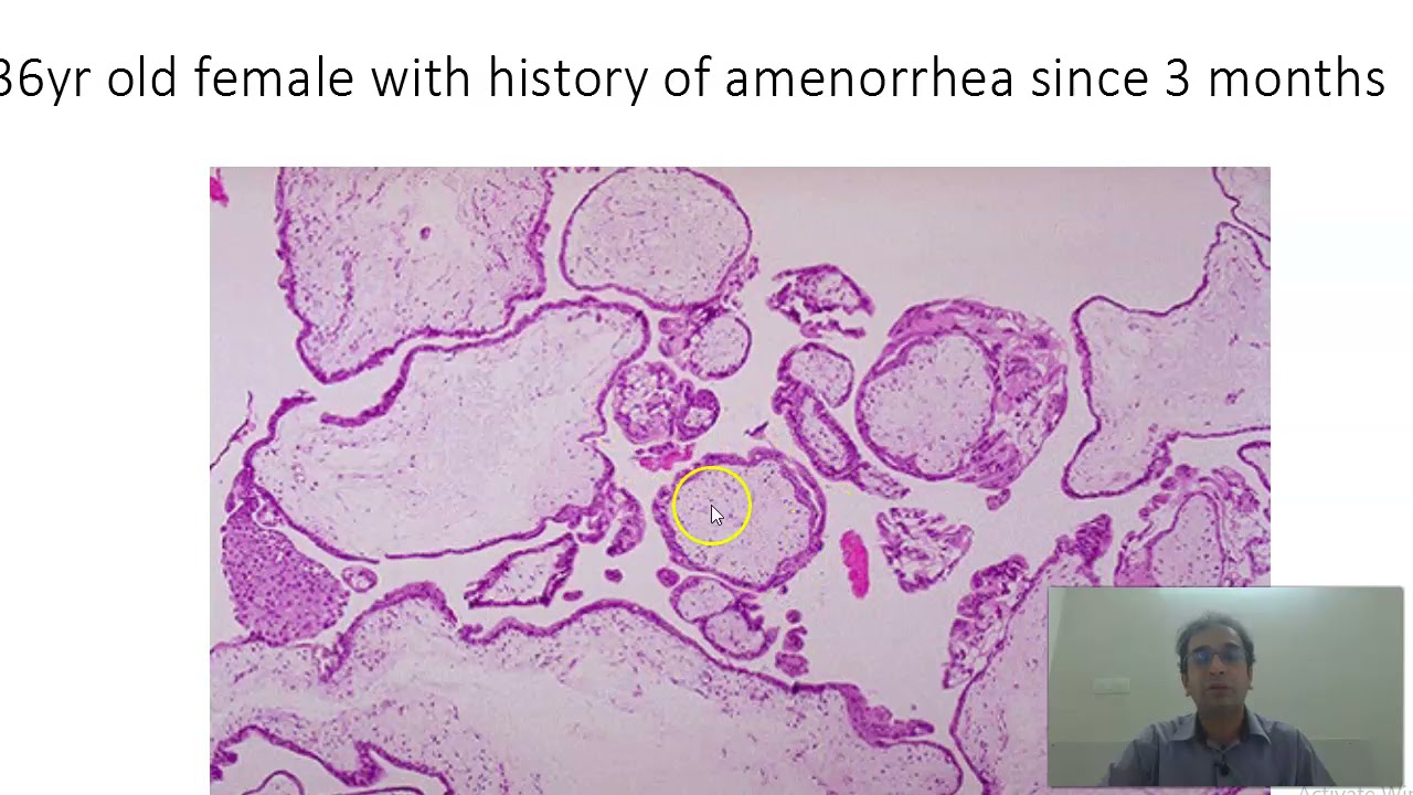Rapid fire MBBS Practical Exam Pathology slides