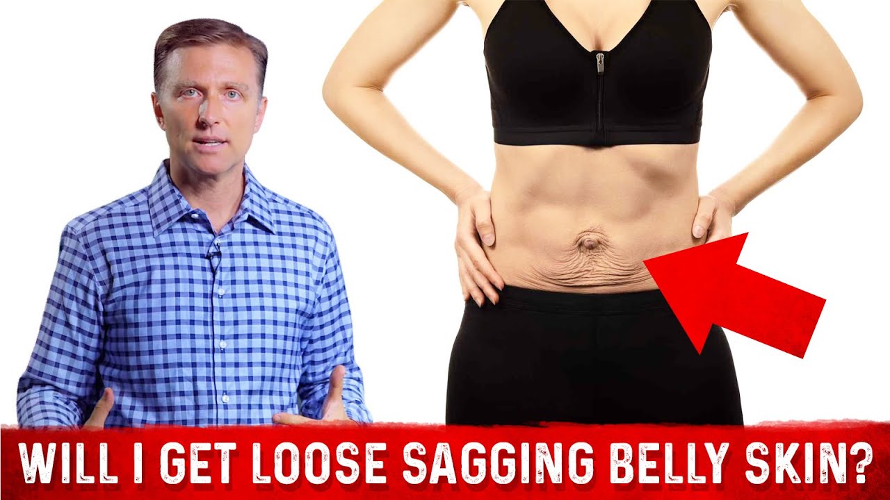 How To Get Rid Of Loose Skin After Weight Loss? &ndash; Dr.Berg On Saggy Belly fat