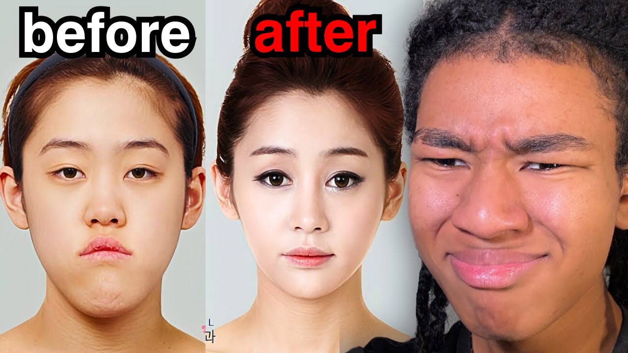 Why Asians Are Addicted To Plastic Surgery