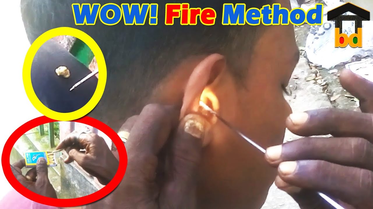 ►Best Ear Waxing Relaxation at Roadside ASMR II Ear Cleaning by Amazing Way II Wash with Input GEL