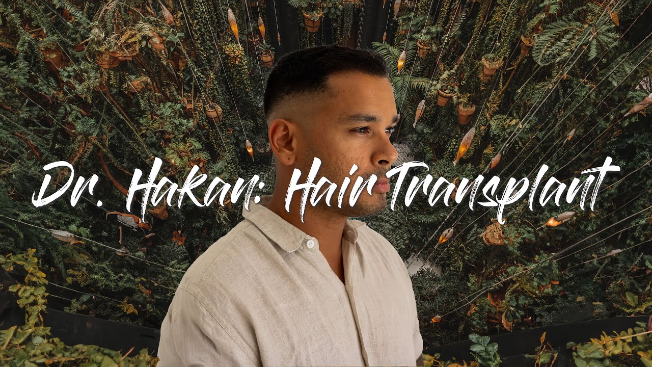 I was going BALD and Dr. Hakan SAVED me! Hair Transplant while traveling full-time.